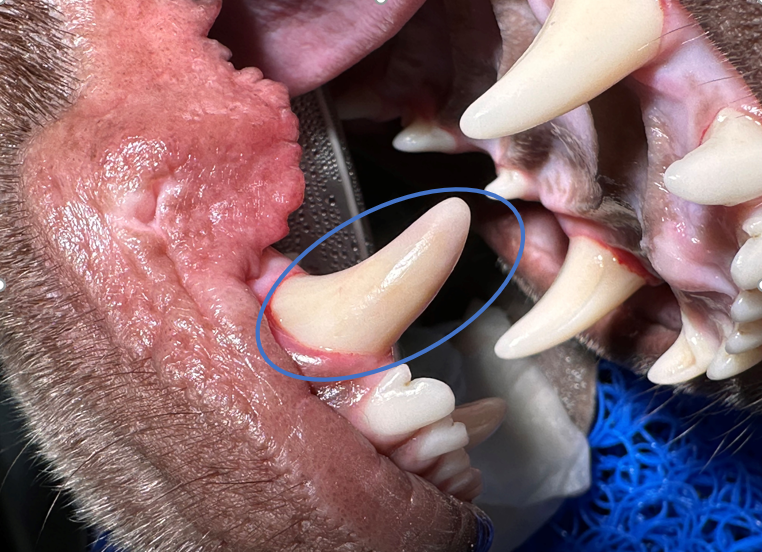 Canine tooth with pulpitis (pink-purple discoloration of the tip)