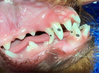 Persistent milk teeth 