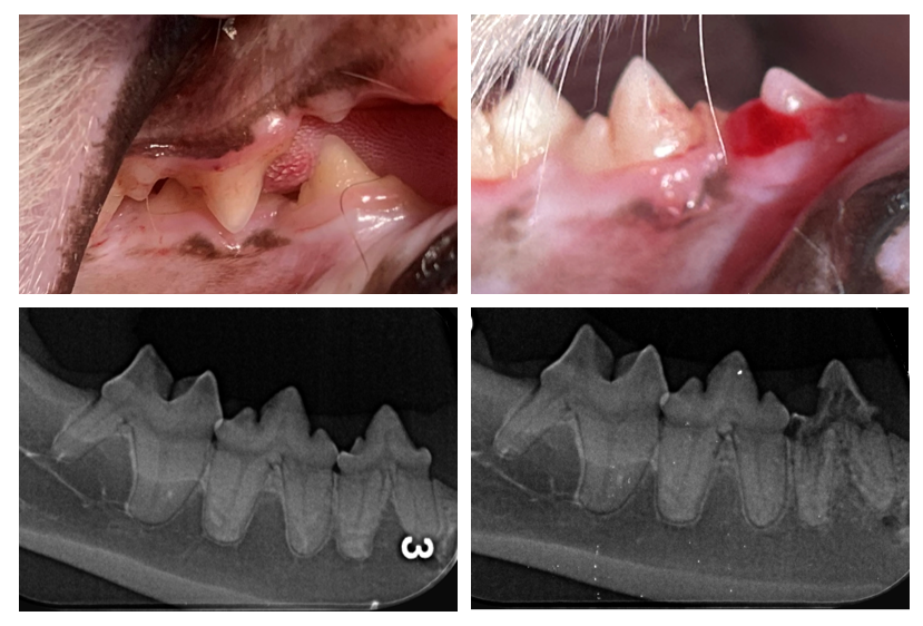  Tooth resorption